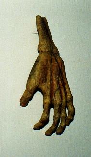 Mumificeret hånd